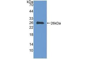 Detection of Recombinant EBI3, Human using Polyclonal Antibody to Epstein Barr Virus Induced Protein 3 (EBI3) (EBI3 antibody  (AA 21-229))