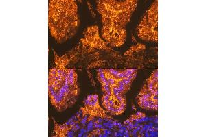 Immunofluorescence (IF) image for anti-Fatty Acid Binding Protein 2, Intestinal (FABP2) antibody (ABIN7267151)