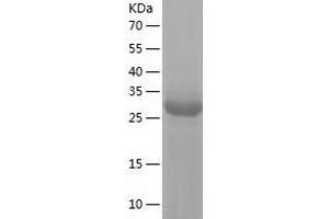 Western Blotting (WB) image for Endonuclease 8-like 2 (NEIL2) (AA 1-332) protein (His tag) (ABIN7288247) (NEIL2 Protein (AA 1-332) (His tag))