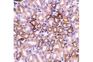 Immunohistochemistry (IHC) image for anti-Nephrosis 1, Congenital, Finnish Type (Nephrin) (NPHS1) (C-Term) antibody (ABIN1030538)