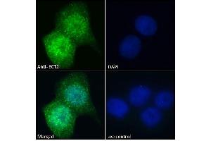 (ABIN185018) Immunofluorescence analysis of paraformaldehyde fixed A431 cells, permeabilized with 0. (ECT2 antibody  (N-Term))