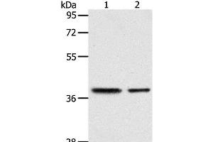 Western Blot analysis of Human fetal kidney and fetal muscle tissue using CNN3 Polyclonal Antibody at dilution of 1:400 (CNN3 antibody)