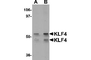 Western Blotting (WB) image for anti-Kruppel-Like Factor 4 (Gut) (KLF4) (C-Term) antibody (ABIN1030469) (KLF4 antibody  (C-Term))