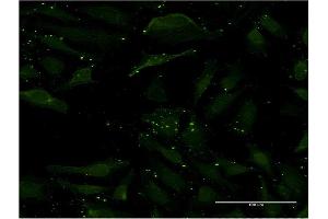 Immunofluorescence of monoclonal antibody to CCL17 on HeLa cell. (CCL17 antibody  (AA 24-94))