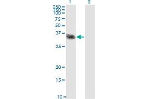 Western Blot analysis of CLEC2D expression in transfected 293T cell line by CLEC2D monoclonal antibody (M01), clone 4C7.