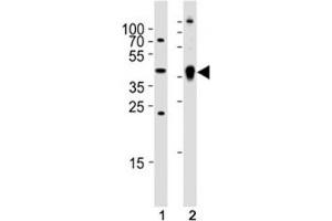 Western blot analysis of (1) zebrafish brain and (2) whole zebrafish tissue lysate using Ada antibody. (ADA antibody  (AA 114-148))