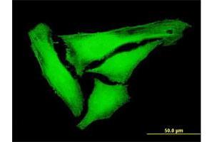 Immunofluorescence of purified MaxPab antibody to KIFC3 on HeLa cell. (KIFC3 antibody  (AA 1-687))