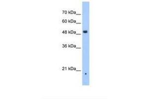 Image no. 1 for anti-Zinc Finger, DHHC-Type Containing 16 (ZDHHC16) (AA 111-160) antibody (ABIN6738666) (ZDHHC16 antibody  (AA 111-160))