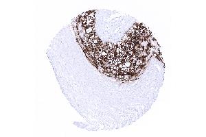 placenta mature amnion and chorion (Recombinant PLAP antibody)