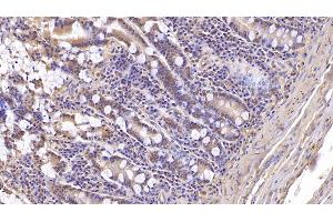 Detection of ASPH in Human Small intestine Tissue using Monoclonal Antibody to Aspartate Beta Hydroxylase (ASPH) (Aspartate beta Hydroxylase antibody  (AA 345-758))
