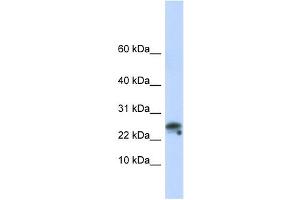 Granulysin antibody used at 1 ug/ml to detect target protein.