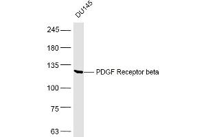 DU145 lysates probed with PDGF Receptor beta Polyclonal Antibody, Unconjugated  at 1:500 dilution and 4˚C overnight incubation. (PDGFRB antibody  (AA 981-1066))