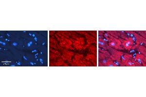 Rabbit Anti-NXF1 Antibody   Formalin Fixed Paraffin Embedded Tissue: Human heart Tissue Observed Staining: Cytoplasmic, nucleus Primary Antibody Concentration: N/A Other Working Concentrations: 1:600 Secondary Antibody: Donkey anti-Rabbit-Cy3 Secondary Antibody Concentration: 1:200 Magnification: 20X Exposure Time: 0.