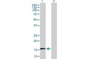 Lane 1: EMP3 transfected lysate ( 18. (EMP3 293T Cell Transient Overexpression Lysate(Denatured))
