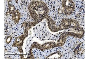 IHC analysis of Cbx8 using anti-Cbx8 antibody (ABIN7599340). (CBX8 antibody  (AA 1-389))