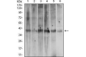 Western blot analysis using ACP5 mouse mAb against A431 (1), T47D (2), HepG2 (3), MOLT4 (4), Jurkat (5) and Hela (6) cell lysate.