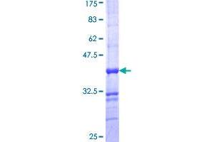 ALPPL2 Protein (AA 365-454) (GST tag)