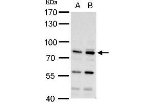 Western Blotting (WB) image for anti-Mdm2, p53 E3 Ubiquitin Protein Ligase Homolog (Mouse) (MDM2) (Center) antibody (ABIN2854782)