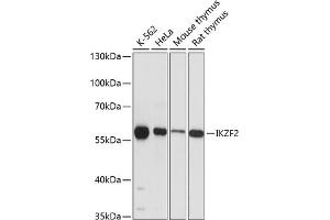 Western blot analysis of extracts of various cell lines, using IKZF2 antibody (ABIN6130817, ABIN6142288, ABIN6142289 and ABIN6215874) at 1:3000 dilution. (IKZF2 antibody  (AA 300-440))