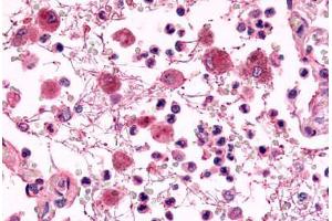 Anti-EMR2 antibody  ABIN1048548 IHC staining of human lung, pneumonia, neutrophils.