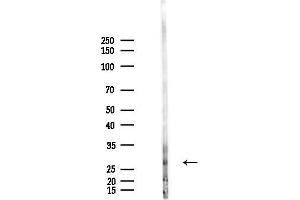 anti-Coiled-Coil Domain Containing 124 (CCDC124) antibody