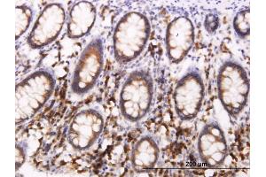 Immunoperoxidase of monoclonal antibody to BCAP29 on formalin-fixed paraffin-embedded human colon. (BCAP29 antibody  (AA 125-241))