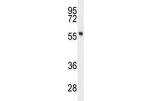 FEZF1 antibody western blot analysis in mouse stomach tissue lysate. (FEZF1 antibody  (AA 67-96))