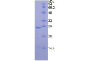SDS-PAGE analysis of Human Desmocollin 1 Protein. (Desmocollin 1 Protein (DSC1))