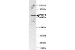 Western blot analysis of POT1 in HeLa nuclear extracts (25 ug) with POT1 polyclonal antibody .