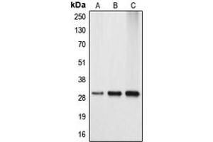 Western blot analysis of APOA1BP expression in HEK293T (A), mouse kidney (B), rat kidney (C) whole cell lysates. (APOA1BP antibody  (Center))