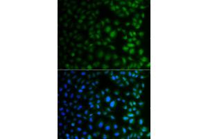 Immunofluorescence analysis of A549 cells using NAA40 antibody (ABIN4904481). (NAA40 antibody)