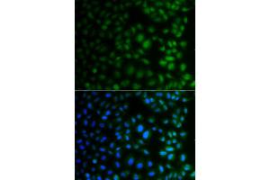 Immunofluorescence analysis of A549 cells using NAA40 antibody (ABIN4904481). (NAA40 antibody)