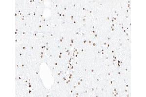 ABIN6266861 at 1/100 staining human brain tissue sections by IHC-P. (PIAS1 antibody  (N-Term))