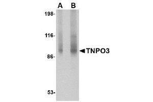 Image no. 1 for anti-Transportin 3 (TNPO3) (N-Term) antibody (ABIN1494360) (Transportin 3 antibody  (N-Term))