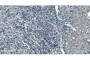 IHC analysis of TIMM8A/DDP using anti-TIMM8A/DDP antibody (ABIN7600039).