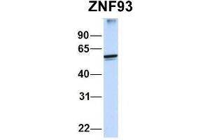 Host:  Rabbit  Target Name:  ZNF93  Sample Type:  Human MCF7  Antibody Dilution:  1. (ZNF93 antibody  (N-Term))