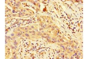 Immunohistochemistry of paraffin-embedded human bladder tissue using ABIN7149795 at dilution of 1:100
