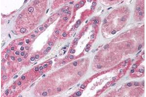 Human Kidney (formalin-fixed, paraffin-embedded) stained with MBD1 antibody ABIN214123 at 10 ug/ml followed by biotinylated goat anti-rabbit IgG secondary antibody ABIN481713, alkaline phosphatase-streptavidin and chromogen. (MBD1 antibody  (C-Term))