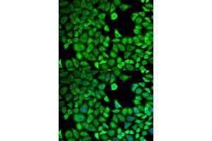 Immunofluorescence analysis of HeLa cells using LTA4H antibody. (LTA4H antibody)