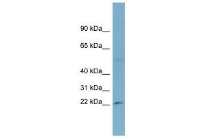 RPL13A antibody used at 1 ug/ml to detect target protein. (RPL13A antibody  (Middle Region))