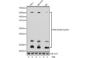 Western blot analysis of extracts of various cell lines using Pan Acetyl-Lysine Polyclonal Antibody at dilution of 1:1000. (Acetylated Lysine antibody)