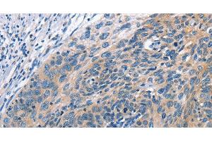 Cullin 7 antibody