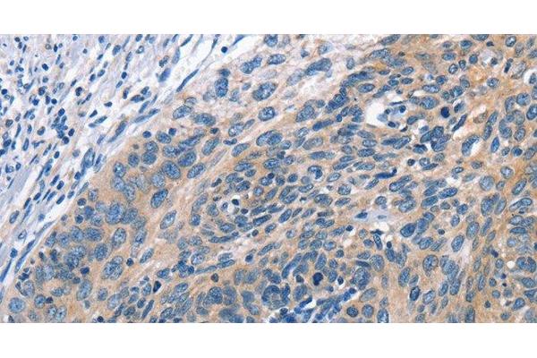 Cullin 7 antibody