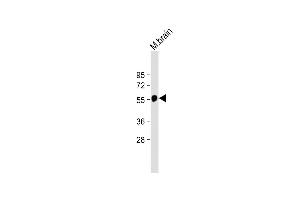 Anti-beta Tubulin Antibody at 1:2000 dilution + Mouse brain lysate Lysates/proteins at 20 μg per lane. (TUBB antibody  (AA 298-328))