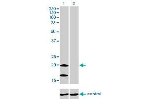 Western blot analysis of NDUFS4 over-expressed 293 cell line, cotransfected with NDUFS4 Validated Chimera RNAi (Lane 2) or non-transfected control (Lane 1). (NDUFS4 antibody  (AA 66-175))