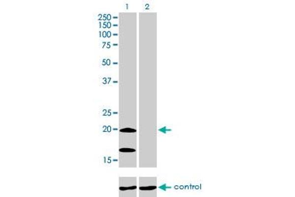 NDUFS4 Antikörper  (AA 66-175)
