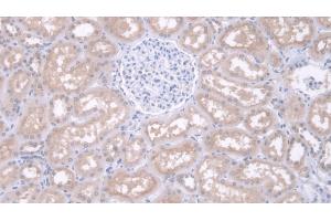 Detection of IDUa in Human Kidney Tissue using Polyclonal Antibody to Iduronidase Alpha L (IDUa) (IDUA antibody  (AA 28-306))