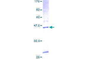 Image no. 1 for KDEL (Lys-Asp-Glu-Leu) Endoplasmic Reticulum Protein Retention Receptor 3 (kDELR3) (AA 1-214) protein (GST tag) (ABIN1308518) (KDELR3 Protein (AA 1-214) (GST tag))