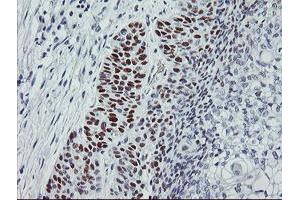 Image no. 1 for anti-Tumor Protein P53 (TP53) antibody (ABIN1499967)