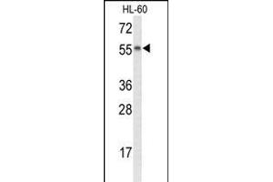 Nyctalopin antibody  (N-Term)